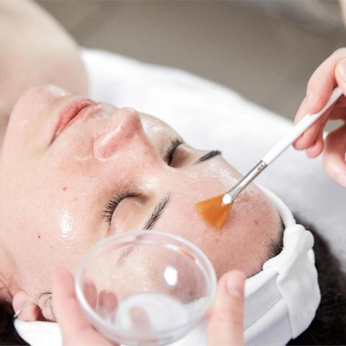 Chemical Peel