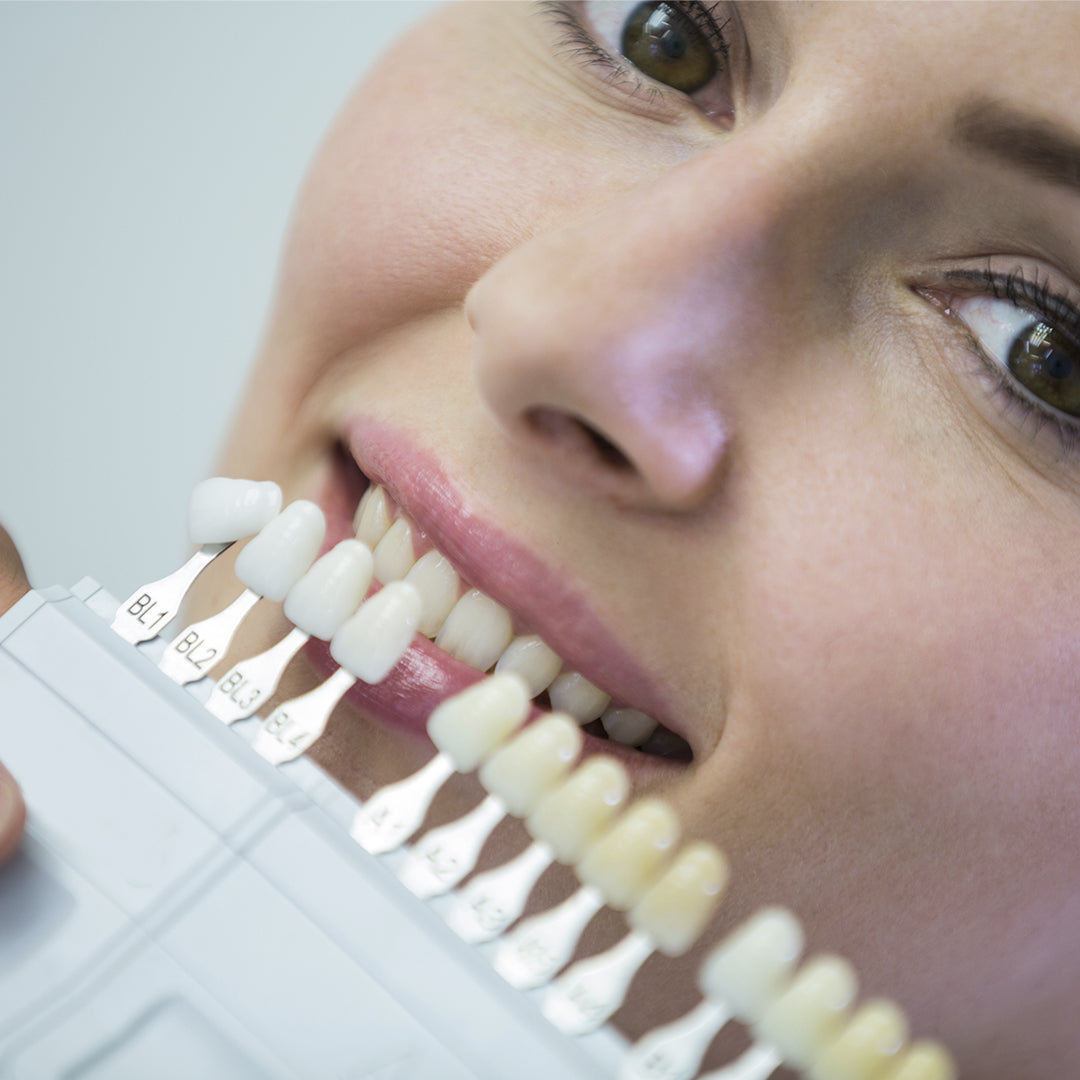 Teeth Whitening