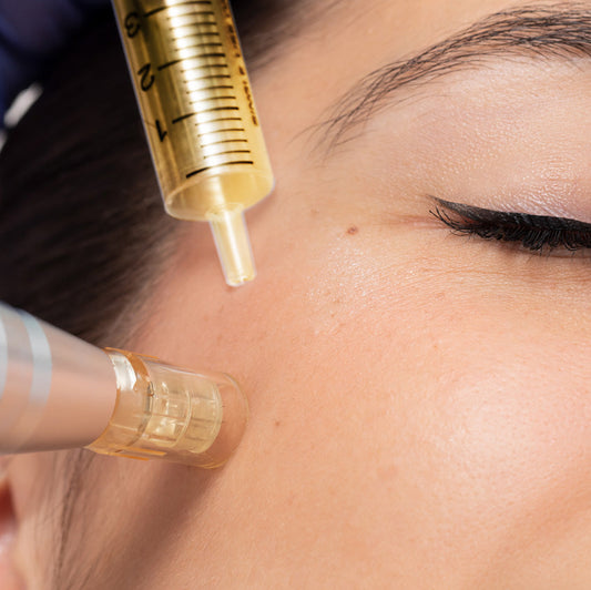 Platelet-Rich Plasma (PRP) Facial